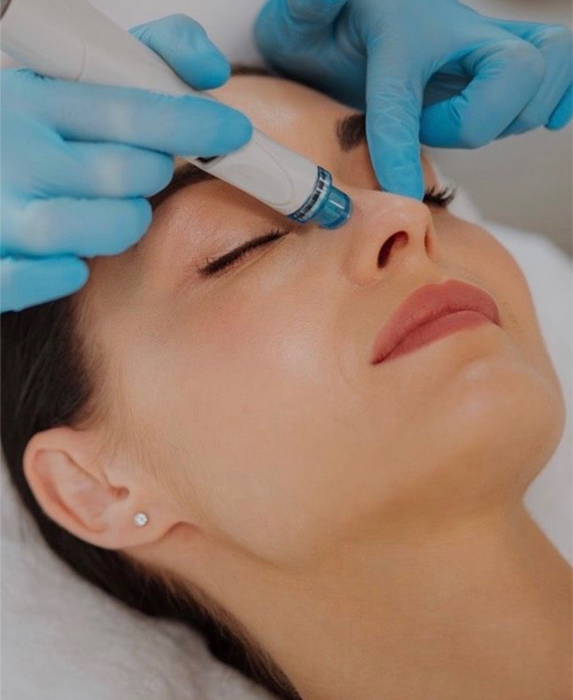 Hydrafacial 